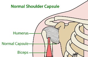 frozen shoulder capsule chiropractic